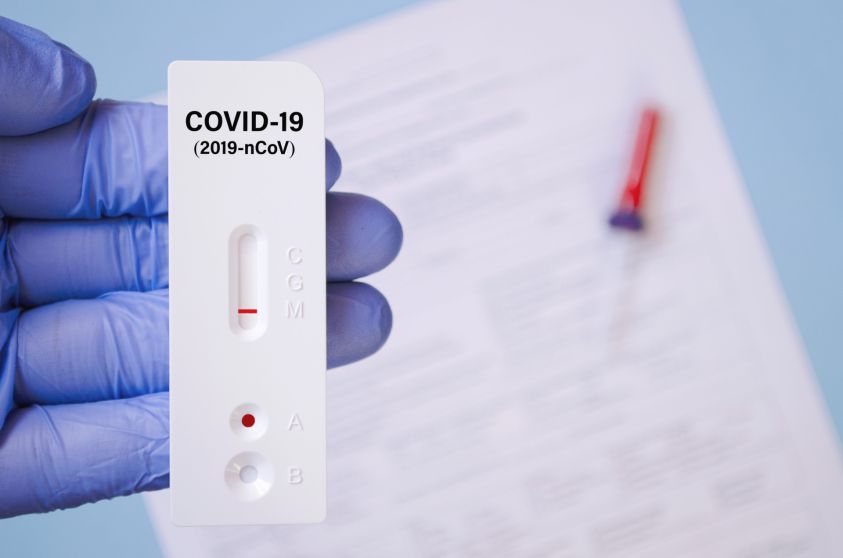 Negative test result by using rapid test for COVID-19, quick fast antibody point of care testing2e00 Lab performing rapid diagnostic test for antibodies to detect presence of antigens COVID-19 disease2e00